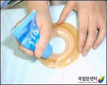 장루주머니 교환 방법(6)