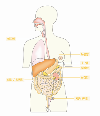 암예방지침서_위험요인별_건강체중