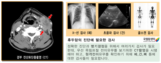 경부 전산화단층촬영(CT)