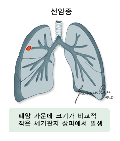 선암종