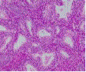 분화도1