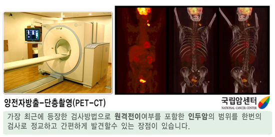 양전자방출-단층촬영(PET-CT)