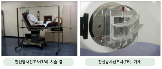 전신 방사선 조사