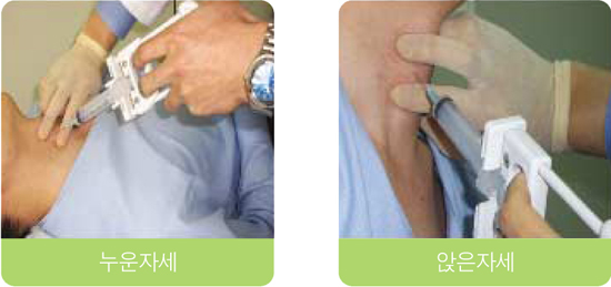예방과검진미리미리-갑상선암의 미세침 흡인 세포검사 모습
