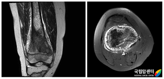 자기공명영상(MRI)